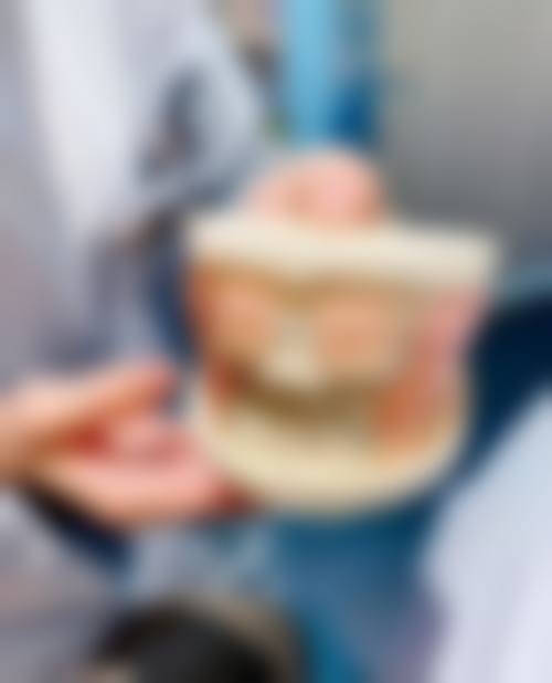 四、种植牙有哪些潜在危害因素