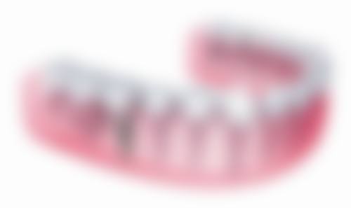 拓展延伸:種牙常見問題拆解
