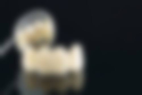 拓展延伸:整牙項目真相+關鍵選擇點+避坑指南