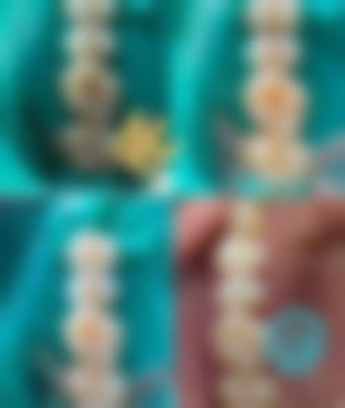 香港大學深圳醫院口腔科價格表/收費標準一覽