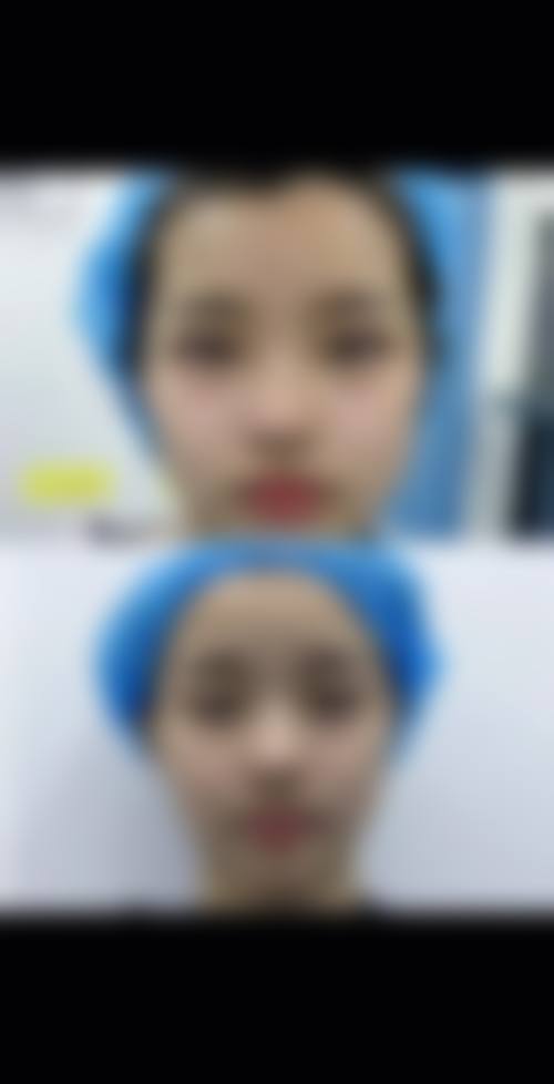 上海方登整形医疗美容诊所治疗反馈与口碑评价。