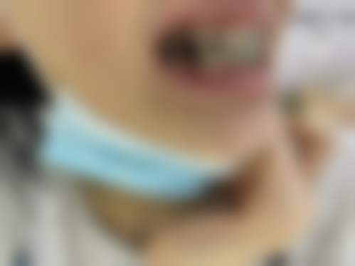 深圳罗湖佳美口腔医院预约挂号方式。