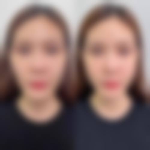 金道演医生的技术实力