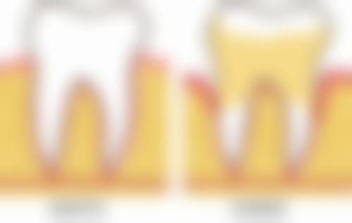 理性提醒：珠海全口牙重建推薦，安心永遠排第一！