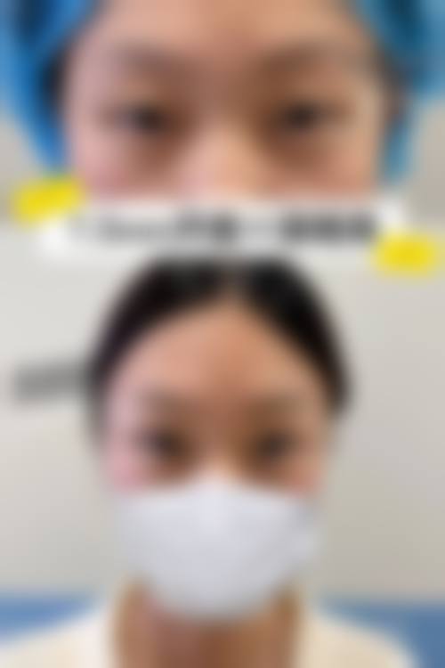北京轻美颜(眼袋提升)医疗美容门诊部擅长项目。