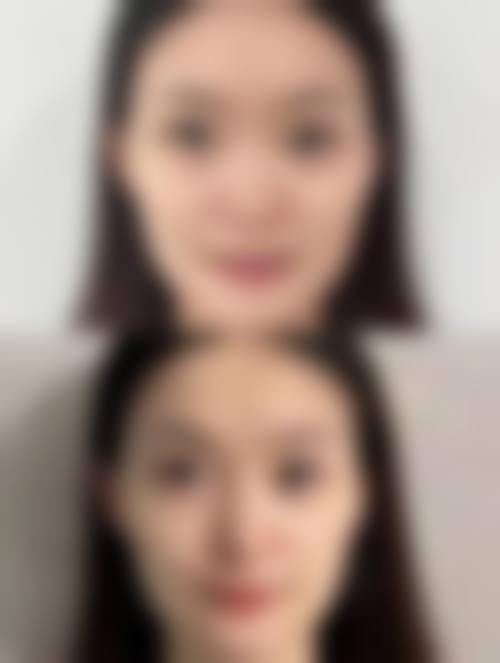 深圳恩吉娜整形医疗美容治疗反馈与口碑评价。
