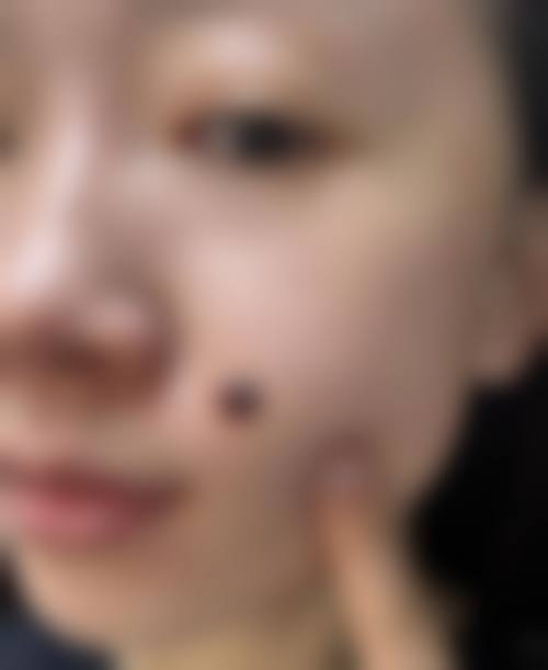 吉化总医院烧伤整形科擅长项目。
