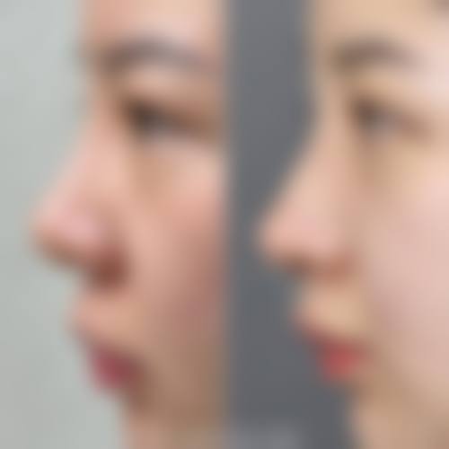 北京新面孔医疗美容门诊部医生团队经验稳定。