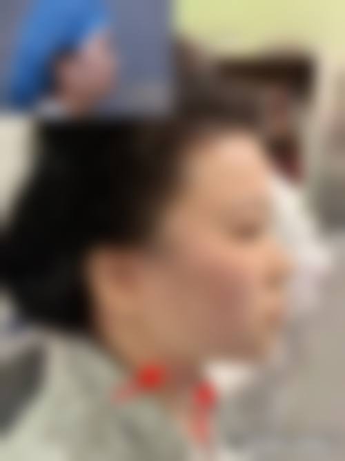 潘俊豪医生的技术实力