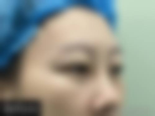 吉化总医院烧伤整形科治疗反馈与口碑评价。