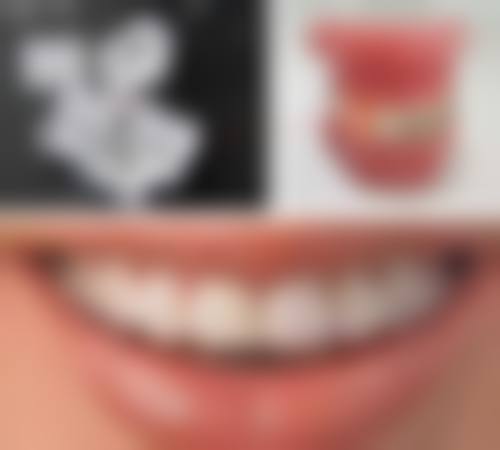 重庆雅可口腔(华宇店)治疗反馈与口碑评价。