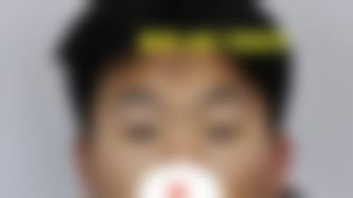重庆市东南医院眼科预约挂号方式。