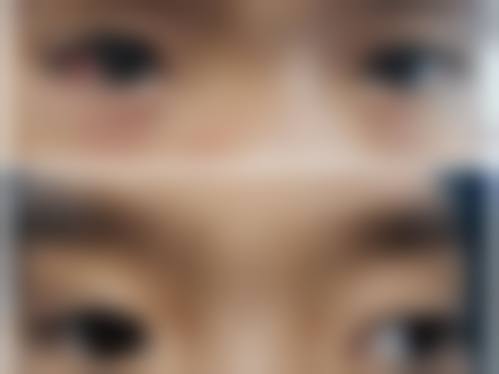 上饶市人民医院眼科治疗反馈与口碑评价。