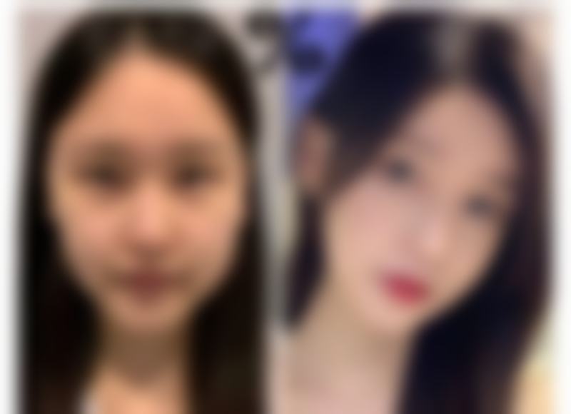 哈尔滨优漾医疗美容门诊部擅长项目