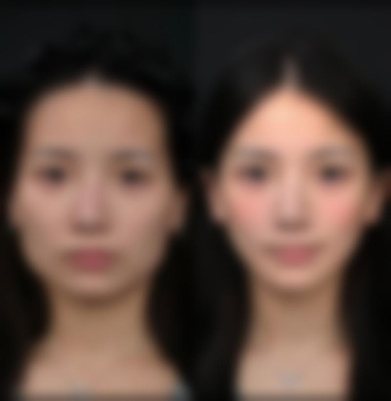 厦门长庚医院整形美容科的口碑评价