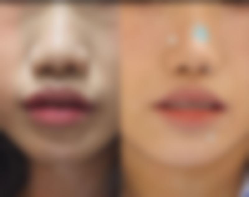 哈尔滨优漾医疗美容门诊部项目价格说明