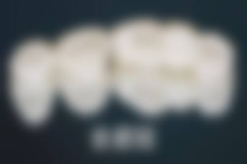 深圳河山口腔近深圳灣口岸 地鐵口190米直達！2026種牙矯正收費+13間連鎖靠譜嗎？