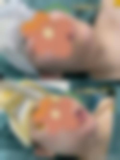 吴政君医生擅长的项目