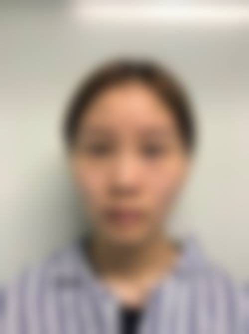 曹中侃医生擅长项目