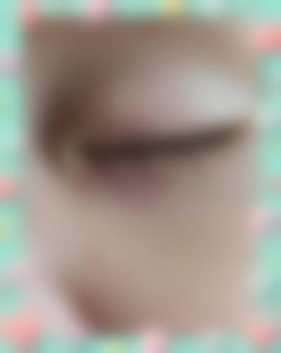 湖州艾目眼科治疗反馈与口碑评价。
