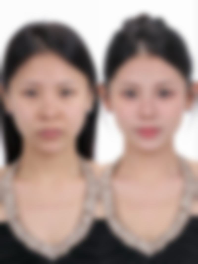 张呈欣医生的擅长项目