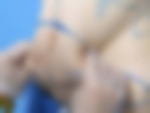 北京美奥整形医院的擅长项目