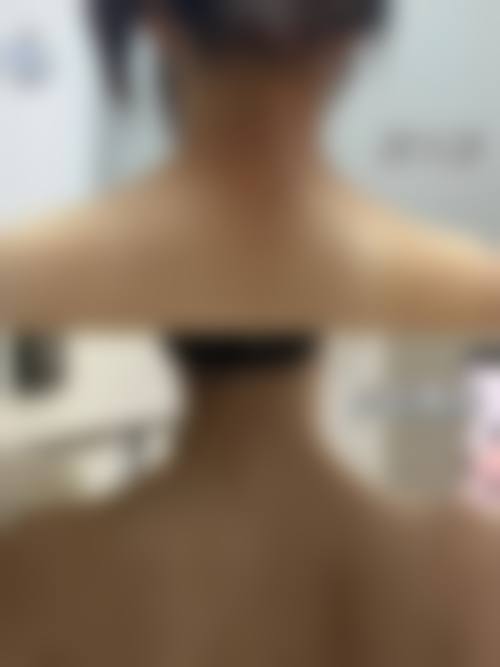 普洱美梵医疗美容诊所治疗反馈与口碑评价。