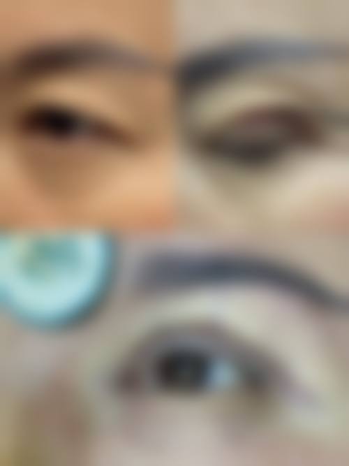 吉林医药学院附属医院眼科治疗反馈与口碑评价。