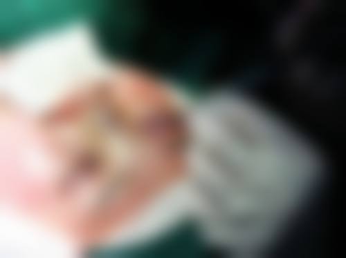 三、郭清华医生技术水平高: