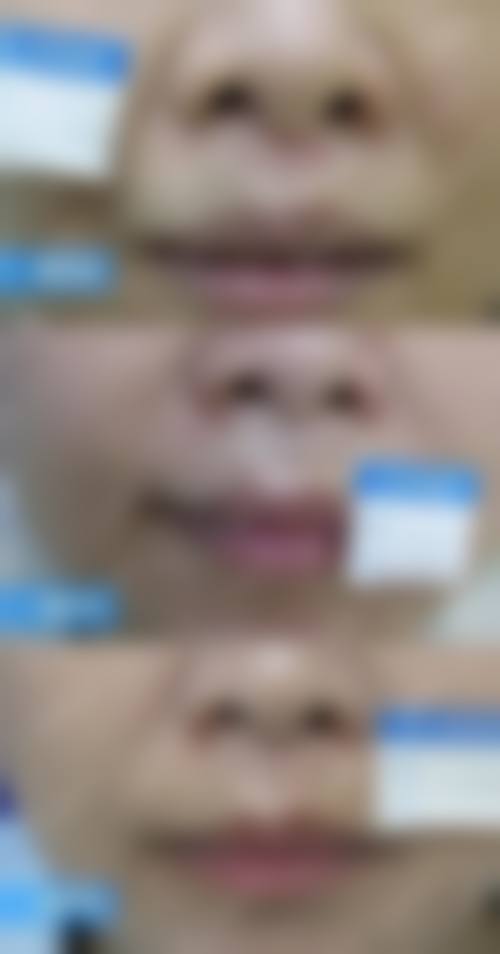 七、保定艾妍庄整形医院口碑如何