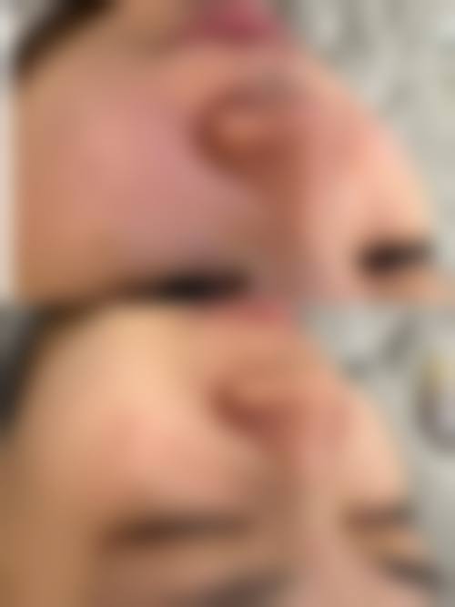 宜春袁州艾莱芙医疗美容整形医院擅长项目。