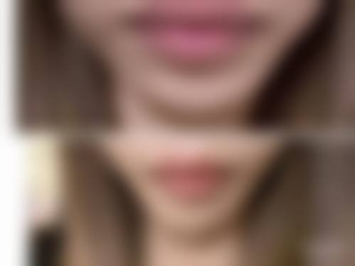 宜春袁州艾莱芙医疗美容整形医院地理位置便于到院。