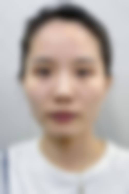 廊坊淳美医疗美容诊所设备精良。