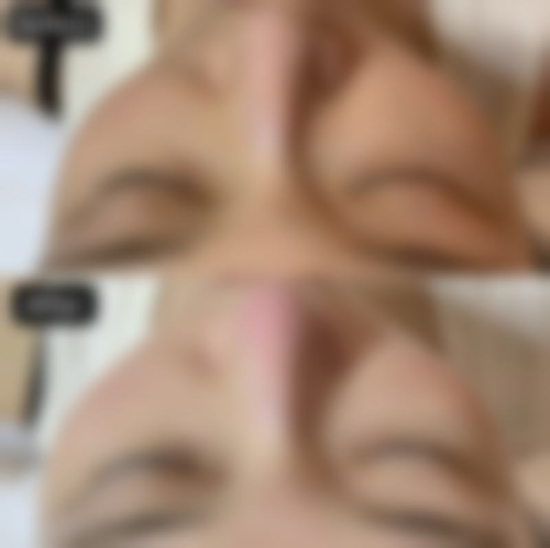南通韩美医疗美容擅长项目
