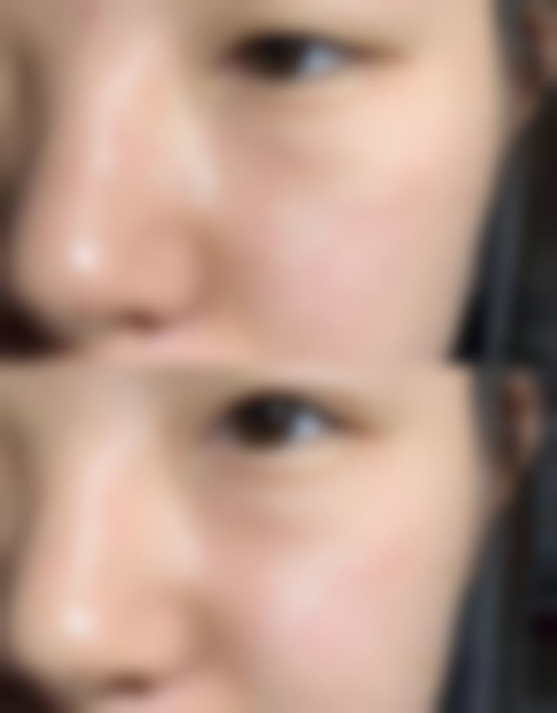 日照瑛琪医疗美容诊所擅长项目。