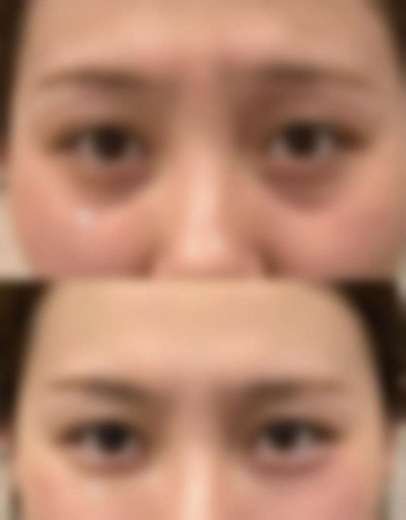 港大醫院皮膚科價錢範圍(HKD):唔使驚畀貴價!