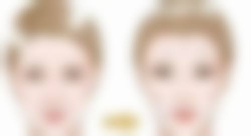 拓展延伸:韓國整形常見問題解答(港澳姊妹版)