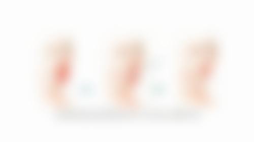韓國童顏針成效真實分享:港澳姊妹術後體驗
