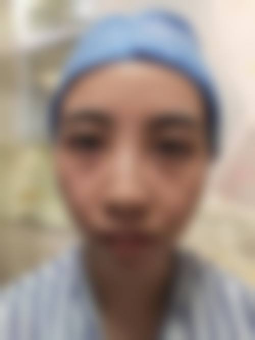 南宁陈石海医疗美容外科诊所擅长项目。