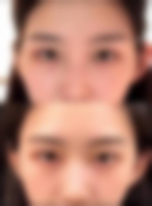 重庆博诚美整形医院2026年价格收费表