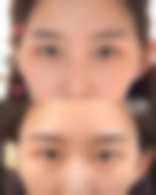重庆博诚美整形医院擅长项目