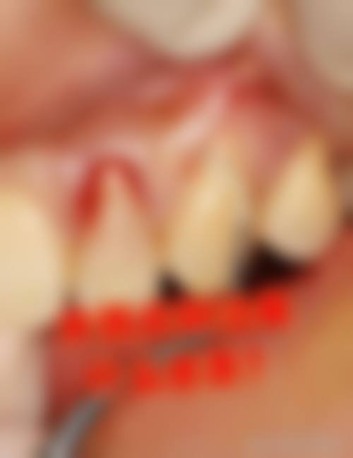溧阳俞贤江口腔门诊部擅长项目。