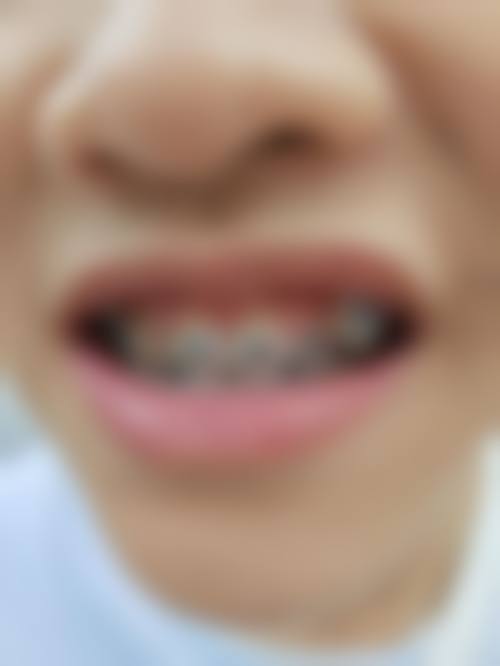 东阳雅博口腔诊所预约挂号方式。