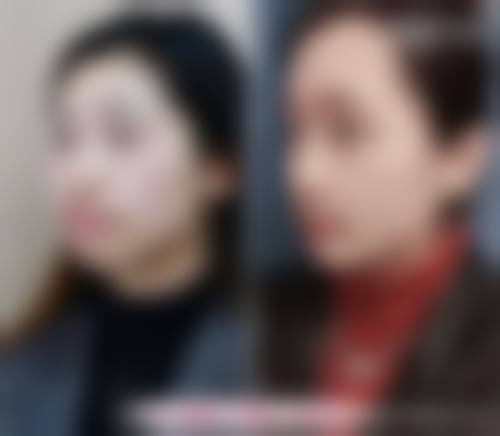 山东潍坊安丘精诚口腔预约挂号方式。