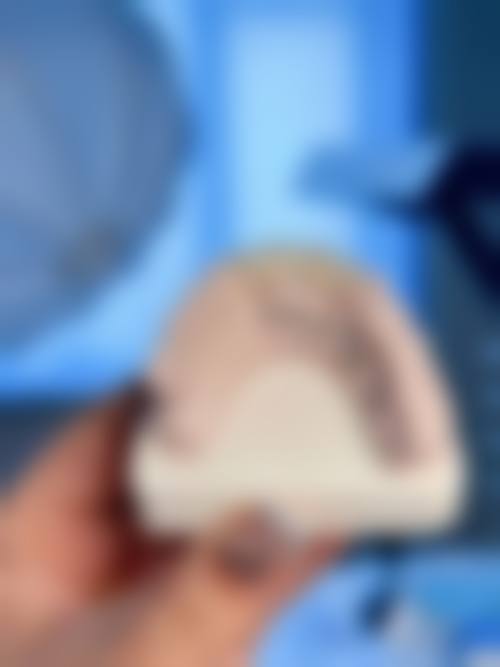 东阳雅博口腔诊所擅长项目。