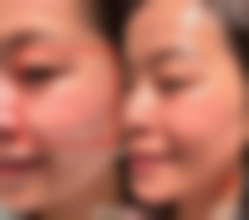 重庆博诚美整形医院医生团队经验稳定