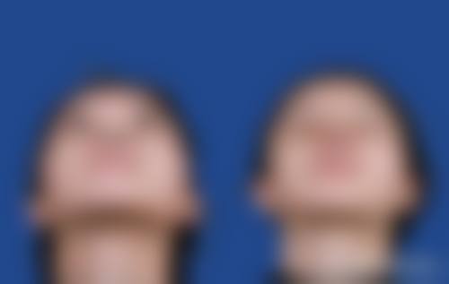 南宁陈石海医疗美容外科诊所治疗反馈与口碑评价。