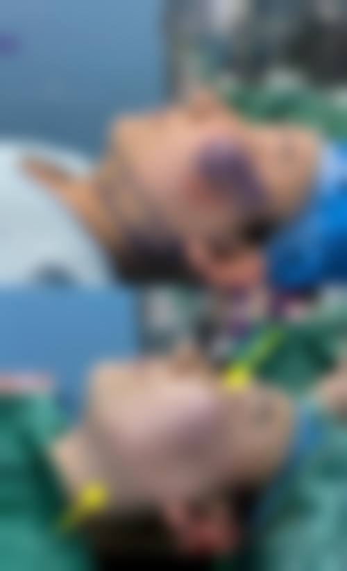 郑州大学第三附属医院医生团队经验稳定。
