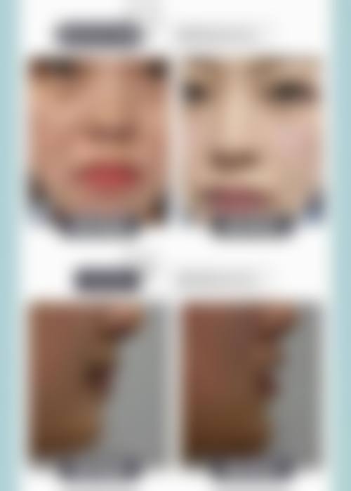 南宁陈石海医疗美容外科诊所预约挂号方式。