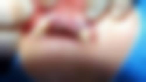 东阳雅博口腔诊所治疗反馈与口碑评价。